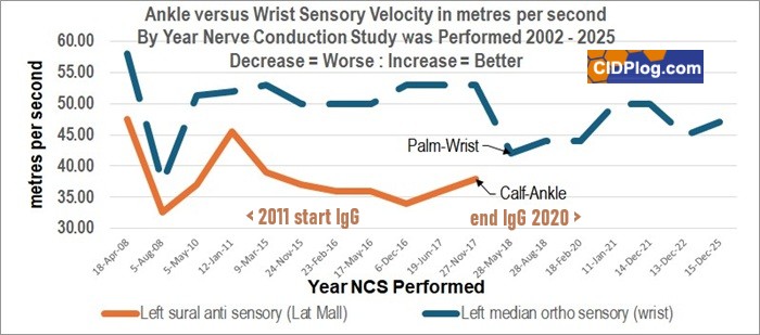 CIDP sensory nerve velocity between 2008 and 2025
